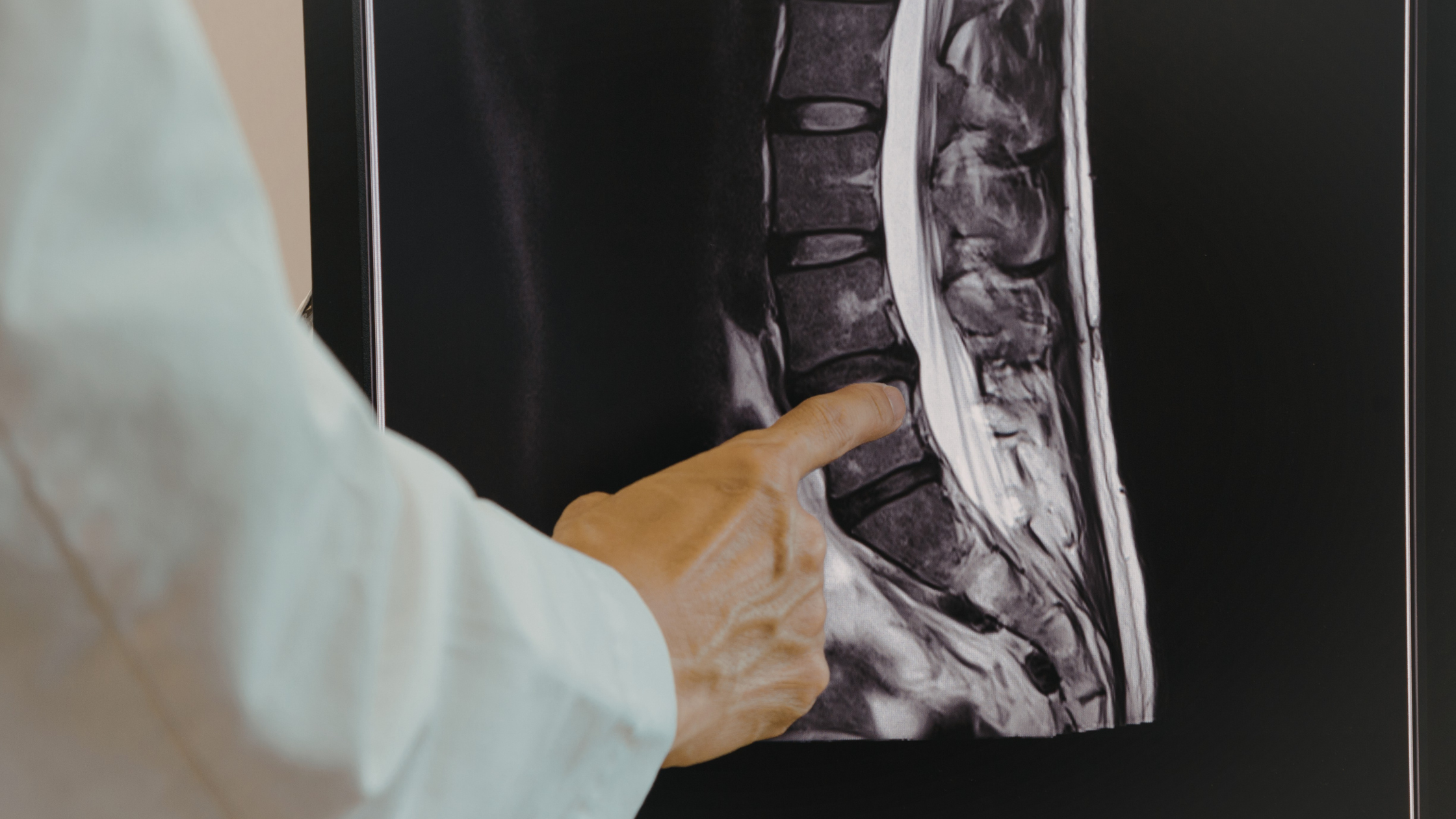 Non-Surgical Spinal Decompression Therapy Near Greenville, SC What It Is and Whether It Can Help You